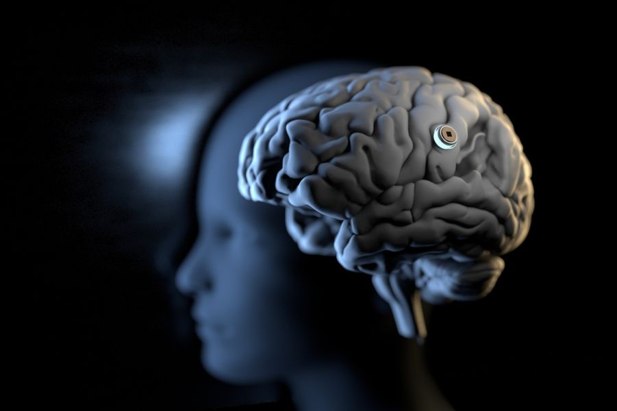  A model of the human brain with an implant, depicted against the background of a blurred human silhouette.